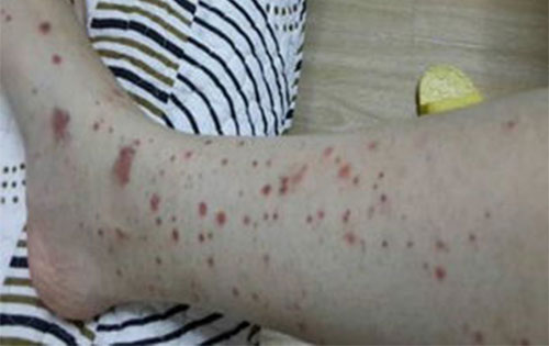 ��������������� ����������֢״